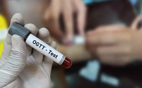 Ręka w rękawiczce trzyma probówkę z krwią z oznaczeniem "OGTT - Test". W tle widać proces pobierania krwi, kluczowy dla test obciążenia glukozą 75g interpretacja wyników.