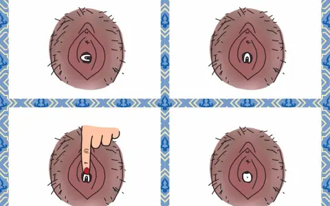 Illustration visar hur en menskopp vecklar ut sig. En hand trycker på den för att hjälpa den att veckla ut sig.