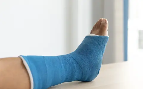 Niebieski gips na nodze po złamaniu trójkostkowym. Czekam na moment, kiedy będę mógł chodzić.
