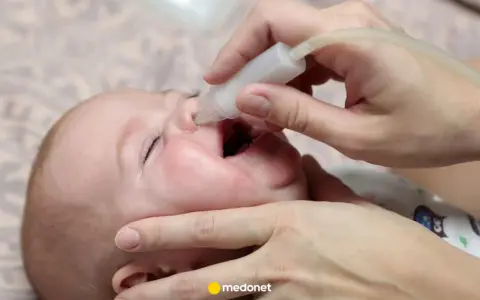 Oczyszczanie noska niemowlaka z wydzieliny, która może być przyczyną mokrego kaszlu.