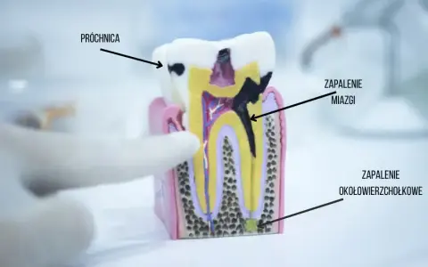 Boli ząb, nie wiesz który? Jak dentysta precyzyjnie znajdzie przyczynę