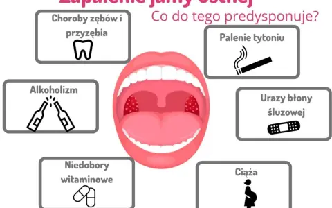 Skuteczne płukanki na stan zapalny jamy ustnej, które przynoszą ulgę
