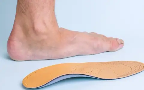 Un pied humain et une semelle orthopédique, conçue pour soulager les douleurs liées aux durillons et aux problèmes de voûte plantaire.