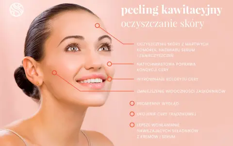 Peeling kawitacyjny to głębokie oczyszczanie skóry, które usuwa martwe komórki, sebum i zanieczyszczenia, poprawiając jej kondycję.