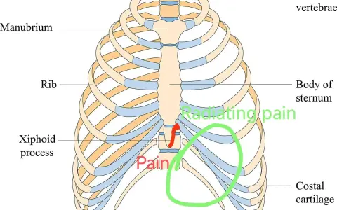 Anatomia klatki piersiowej z zaznaczonym wyrostkiem mieczykowatym i obszarem bólu.