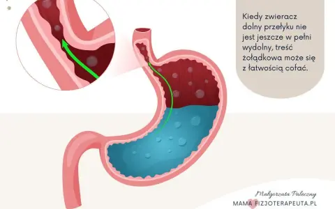 Ilustracja pokazuje żołądek i przełyk, wyjaśniając mechanizm ukrytego refluksu u niemowlaka, gdy treść żołądkowa cofa się do przełyku.