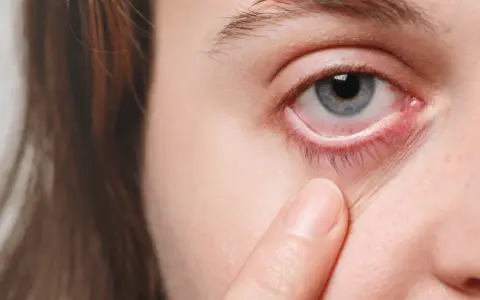 Sjögren Syndrom Diagnostik: Symptome, Tests und häufige Herausforderungen