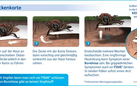 Anleitung zur Zeckenentfernung mit einer Karte: flach unter die Zecke schieben, fixieren und senkrecht herausziehen. Beobachten Sie die Stelle.