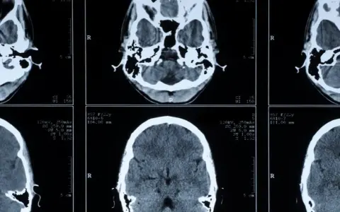 Die Bedeutung der medizinischen Diagnostik für präzise Krankheitsdiagnosen