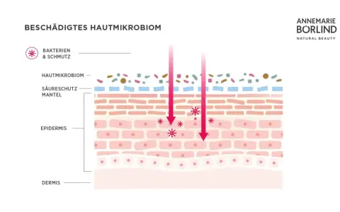 Illustration zeigt ein geschädigtes Hautmikrobiom mit Bakterien und Schmutz, die in die Epidermis eindringen.