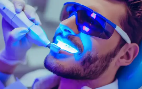 Wybielanie zębów u dentysty: czy warto? Analiza kosztów i efektów