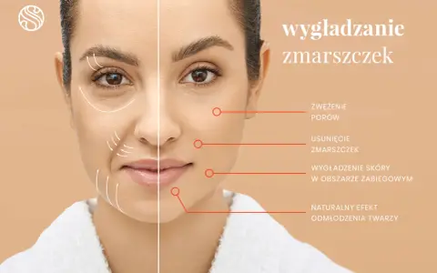Kobieta z widocznymi zmarszczkami mimicznymi po jednej stronie twarzy, po drugiej wygładzona skóra. Efekt odmłodzenia.