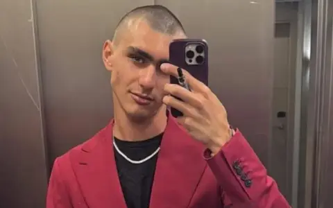 Achille Costacurta, con un look audace e un sorriso enigmatico, sembra affrontare i suoi problemi con stile, sfoggiando un completo fucsia e una collana scintillante.