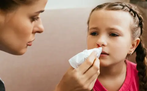 Mama delikatnie przykłada chusteczkę do nosa dziecka, na którym widać ślady krwi.