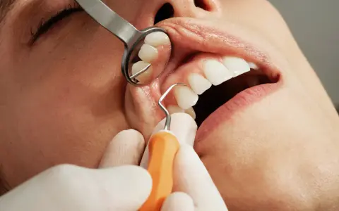 Dentysta bada zęby, oceniając stan szkliwa i potencjalną erozję szkliwa.