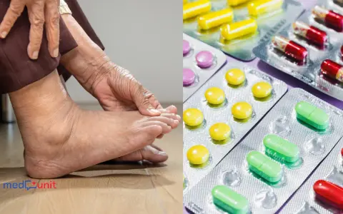 Dna moczanowa: Leki bez recepty na ostry atak i szybka ulga w bólu