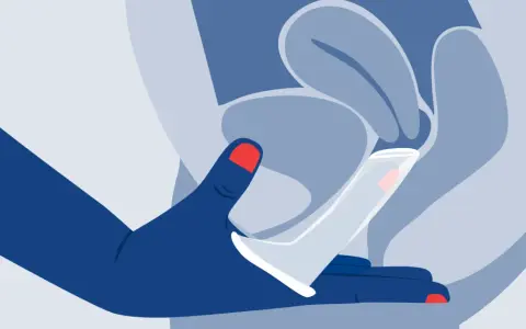 Ilustración de mano insertando un condón femenino. Explora los diversos tipos de condones femeninos para una protección segura.