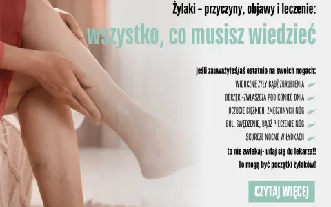 Żylaki? Jak zapobiec i cieszyć się lekkimi nogami każdego dnia