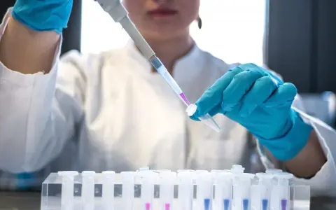 Ricerca per la terapia monoclonale: una mano guantata usa un contagocce per trasferire un liquido viola in una provetta, parte di un esperimento in laboratorio.