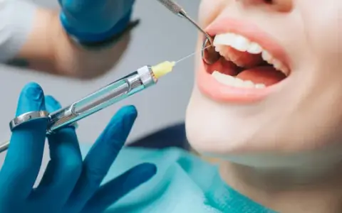 Czy na NFZ przysługuje znieczulenie u dentysty? Sprawdź zasady i warunki
