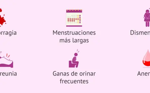 Síntomas como metrorragia, dismenorrea o dispareunia pueden indicar qué es un mioma.