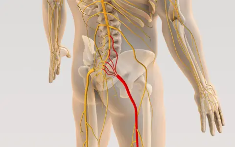 Anatomia układu nerwowego z zaznaczonym nerwem w kolorze czerwonym, wskazującym na potencjalną stenoza kanału kręgowego.