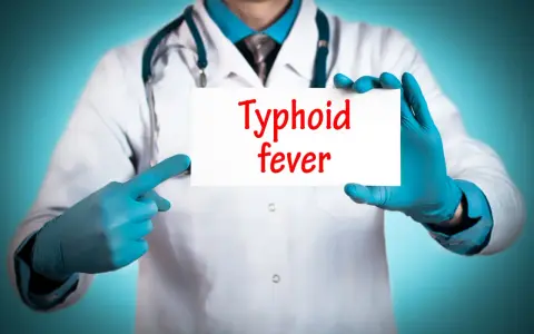Läkare med blå handskar pekar på en skylt med texten "Typhoid fever".