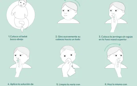 Ilustración paso a paso para el lavado nasal de un bebé. Incluye cómo colocarlo, girar su cabeza, usar la jeringa y limpiar su nariz.