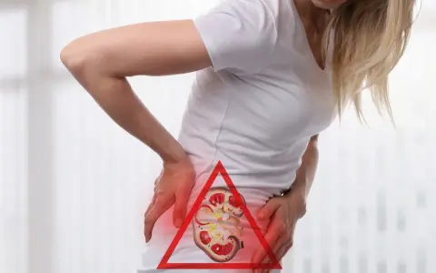 Kobieta trzyma się za bolący bok, gdzie widoczny jest przekrój nerki z kamieniami. Czy przy kamicy nerkowej boli brzuch?