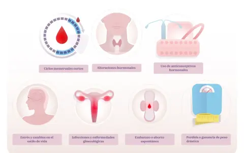 Ilustración muestra posibles causas de la regla cada 15 días: ciclos cortos, alteraciones hormonales, anticonceptivos, estrés, infecciones, embarazo o cambios de peso.