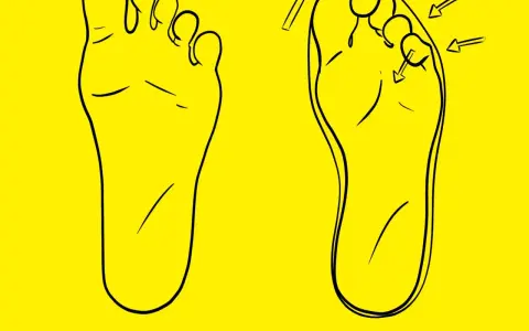 Dos pies dibujados en negro sobre fondo amarillo. Uno muestra el pie normal, el otro el pie con el segundo dedo más largo, el llamado dedo griego.
