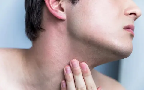 Hombre tocando su cuello con irritación y pequeños granos después de afeitarse.