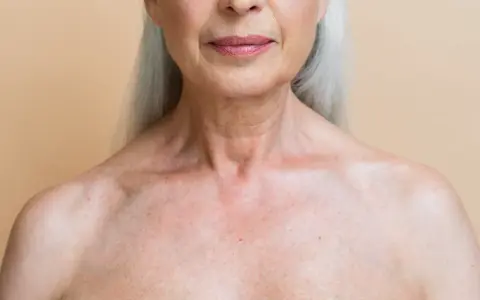 Gros plan sur le décolleté d'une femme âgée, montrant les marques du temps et les dégâts du soleil sur la peau.