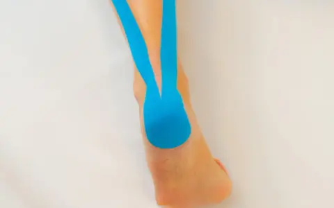 Blaues Kinesio-Tape stützt den Fuß und Unterschenkel, um Schmerzen zu lindern.