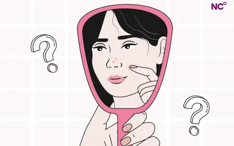 Una mujer se mira en un espejo, examinando granos en su rostro. ¿Será esto un sangrado por deprivación?