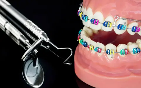 Model szczęki z kolorowym aparatem ortodontycznym i narzędziami dentystycznymi. Idealne do ćwiczeń na tyłozgryz.