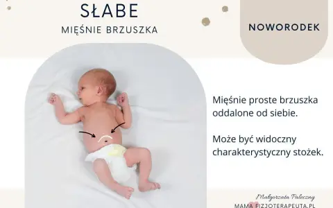 Noworodek z widocznym, wzdętym brzuchem. Mięśnie proste brzuszka są oddalone, tworząc charakterystyczny stożek.