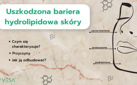 Uszkodzona bariera hydrolipidowa skóry: zaczerwieniona, przesuszona, podrażniona. Jak odbudować naskórek?