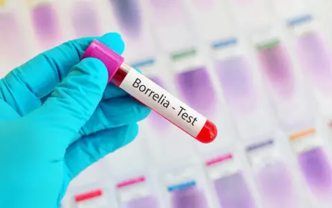 Ręka w niebieskiej rękawiczce trzyma probówkę z napisem "Borrelia - Test". To klucz do odpowiedzi, gdzie zrobić badania na boreliozę.