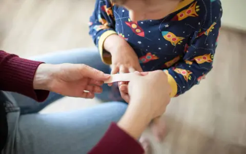 Un pansement appliqué sur un petit doigt, un remède grand-mère brûlure main réconfortant.
