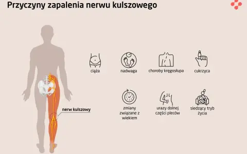 Ból i opuchlizna po przewianiu? To może być zapalenie nerwu!