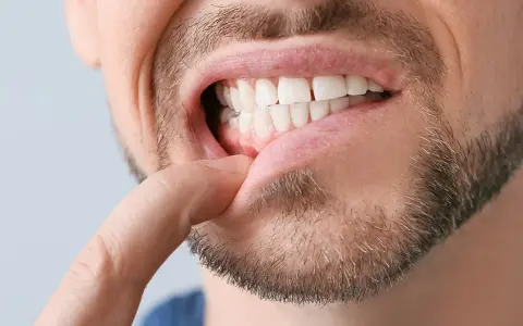 Ropa na dziąśle: Jak bezpiecznie usunąć i kiedy do dentysty?