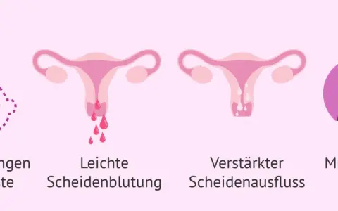 Brustveränderungen, leichte Blutungen, verstärkter Ausfluss und Müdigkeit können Anzeichen sein, dass die periode bleibt aus.