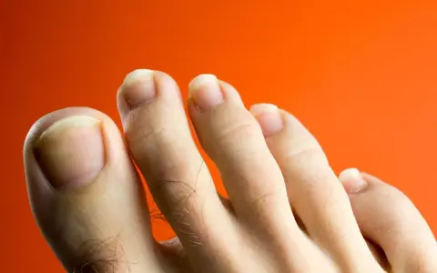 Primer plano de unos pies con uñas amarillas sobre fondo naranja.