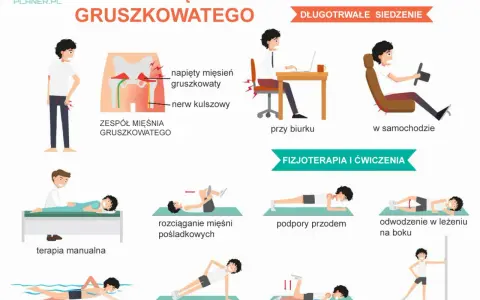 Ilustracja pokazuje zespół mięśnia gruszkowatego, jego przyczyny (długotrwałe siedzenie) i metody leczenia (fizjoterapia, ćwiczenia).