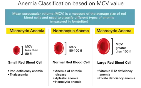 Anemia co to? Porównanie wielkości czerwonych krwinek: mikrocytarna (małe), normocytarna (normalne), makrocytarna (duże).
