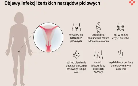 Ilustracja przedstawia sylwetkę kobiety z powiększeniem narządów płciowych i ikonami objawów infekcji.