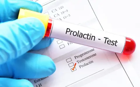 Hiperprolaktynemia: objawy, diagnostyka i jak obniżyć prolaktynę?