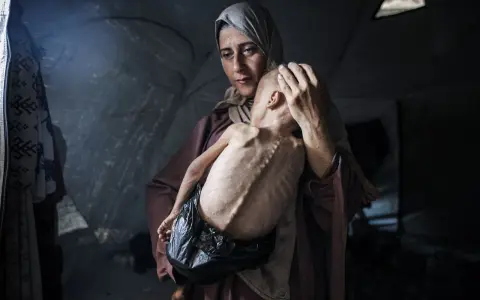 Een moeder troost haar ondervoede kind in een tent. Dit is wat er gebeurt in Gaza: honger en wanhoop.