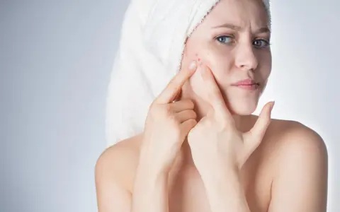 Ragazza con asciugamano in testa che si tocca il viso, preoccupata per un brufolo. La sua pelle mostra segni di imperfezioni.